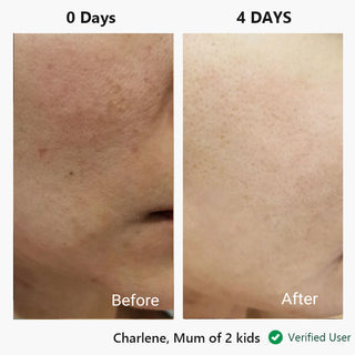 nor sken restore™ facial cream